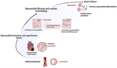 Immuno-inflammatory pathogenesis in ischemic heart disease: perception and knowledge for neutrophil recruitment